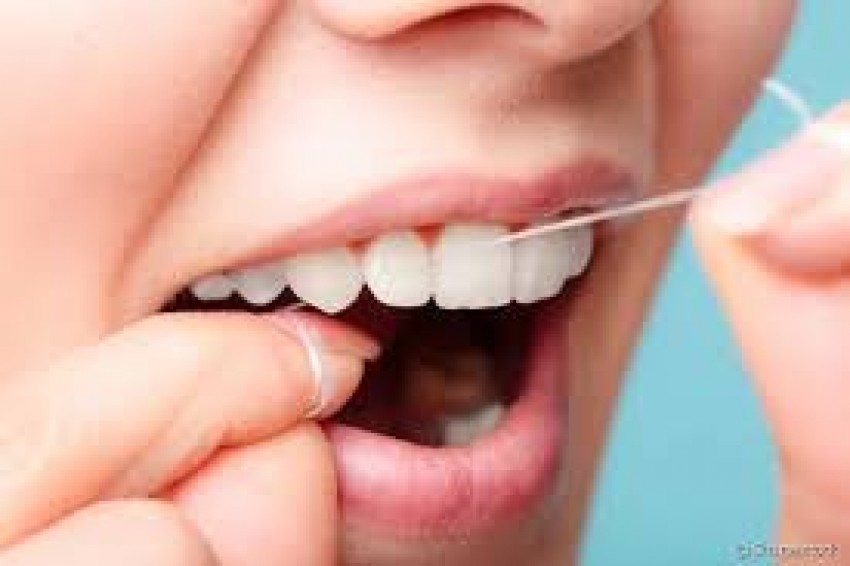 Como usar o fio dental: o uso diário do fio dental ajuda a evitar a placa bacteriana e as cáries